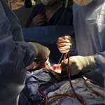 Surgeon Allegedly Left 16 Items In Body After Operation